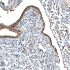 Anti-NUDT16L1 Antibody