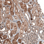 Anti-NUDT16L1 Antibody