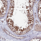 Anti-NUDT16L1 Antibody