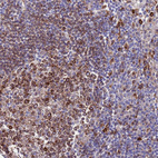 Anti-GREB1L Antibody