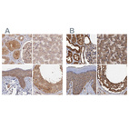 Anti-PSMD9 Antibody