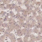 Anti-PSMD9 Antibody