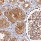 Anti-PSMD9 Antibody