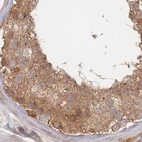 Anti-PSMD9 Antibody