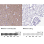 Anti-RTN1 Antibody