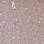 Immunohistochemical staining of human cerebral cortex shows moderate to strong positivity in neurons.