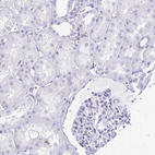 Immunohistochemical staining of human kidney shows moderate to strong cytoplasmic positivity in cells in tubules.