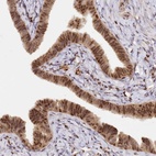 Anti-SECISBP2 Antibody