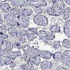 Anti-NSMF Antibody