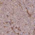 Anti-ARRDC1 Antibody