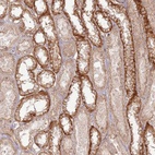 Anti-ZNF623 Antibody