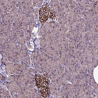 Anti-ZNF329 Antibody