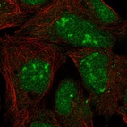 Anti-L3MBTL3 Antibody