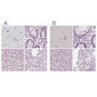 Anti-PNOC Antibody