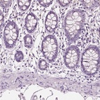 Anti-PNOC Antibody