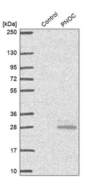 Anti-PNOC Antibody