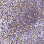 Anti-CD72 Antibody