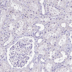 Anti-CD72 Antibody