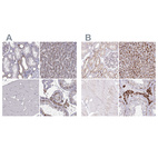 Anti-TPP1 Antibody