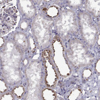 Anti-TPP1 Antibody