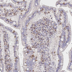 Anti-PIK3CD Antibody