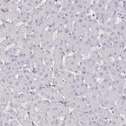 Anti-PIK3CD Antibody