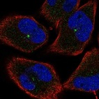 Anti-EEF1AKMT3 Antibody