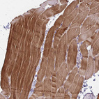 Anti-CFL2 Antibody