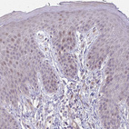 Anti-CFL2 Antibody