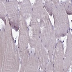 Immunohistochemical staining of human skeletal muscle shows low expression as expected.