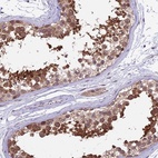 Immunohistochemical staining of human testis shows high expression.