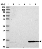 Lane 1: Marker [kDa] 250, 130, 95, 72, 55, 36, 28, 17, 10_br/_Lane 2: Human cell line RT-4_br/_Lane 3: Human cell line U-251MG sp_br/_Lane 4: Human plasma (IgG/HSA depleted)_br/_Lane 5: Human liver tissue_br/_Lane 6: Human tonsil tissue