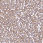 Anti-TYW5 Antibody