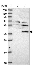 Anti-TYW5 Antibody