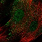 Anti-IL13RA2 Antibody