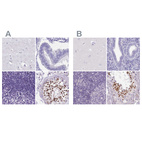 Anti-SPESP1 Antibody