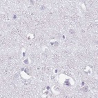 Anti-SPESP1 Antibody