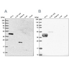 Anti-SPESP1 Antibody