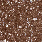 Anti-SV2B Antibody