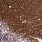 Anti-SV2B Antibody