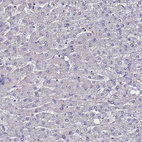 Anti-SV2B Antibody