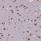 Immunohistochemical staining of human cerebral cortex shows high expression.