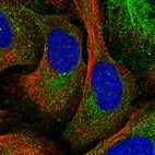 Immunofluorescent staining of human cell line U-2 OS shows localization to cytosol.