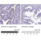 Anti-CFAP100 Antibody