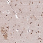 Anti-AF165138.7 Antibody