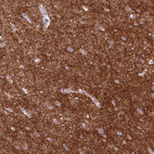 Anti-SCAMP5 Antibody