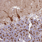 Anti-SCAMP5 Antibody