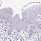 Anti-SCAMP5 Antibody