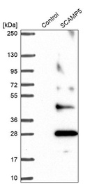 Anti-SCAMP5 Antibody