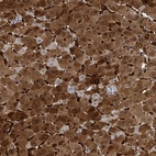 Anti-ZNF771 Antibody